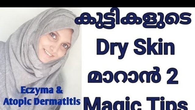 '2 Magic Tips for Baby Dry Skin & Eczyma | How to Cure Baby Dry Skin Malayalam'