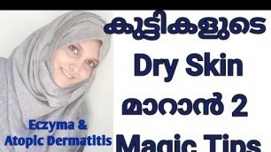 '2 Magic Tips for Baby Dry Skin & Eczyma | How to Cure Baby Dry Skin Malayalam'