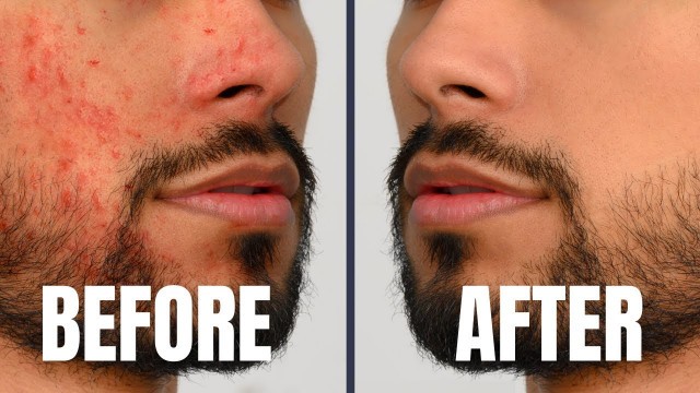 '7 Skin Care Tricks Attractive/Handsome Guys Do DAILY'