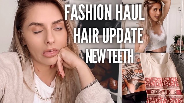 'VLOG - New Teeth, Fashion / Beauty Haul & A Hair Update | Fashion Influx'